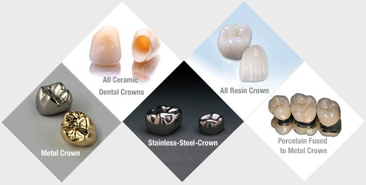 dental crowns
